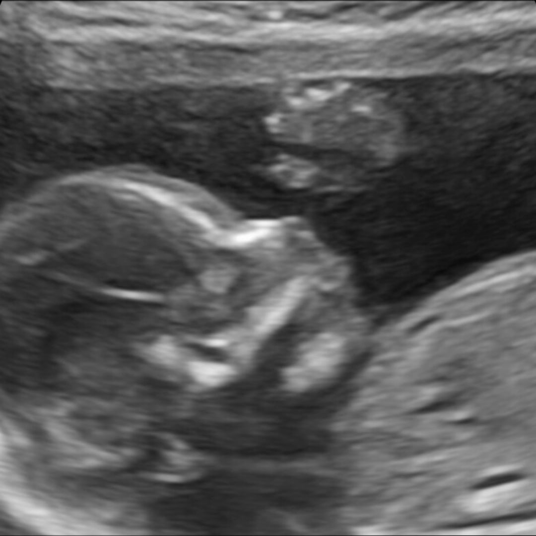 Photo shared by Grace for their Babylist baby registry.