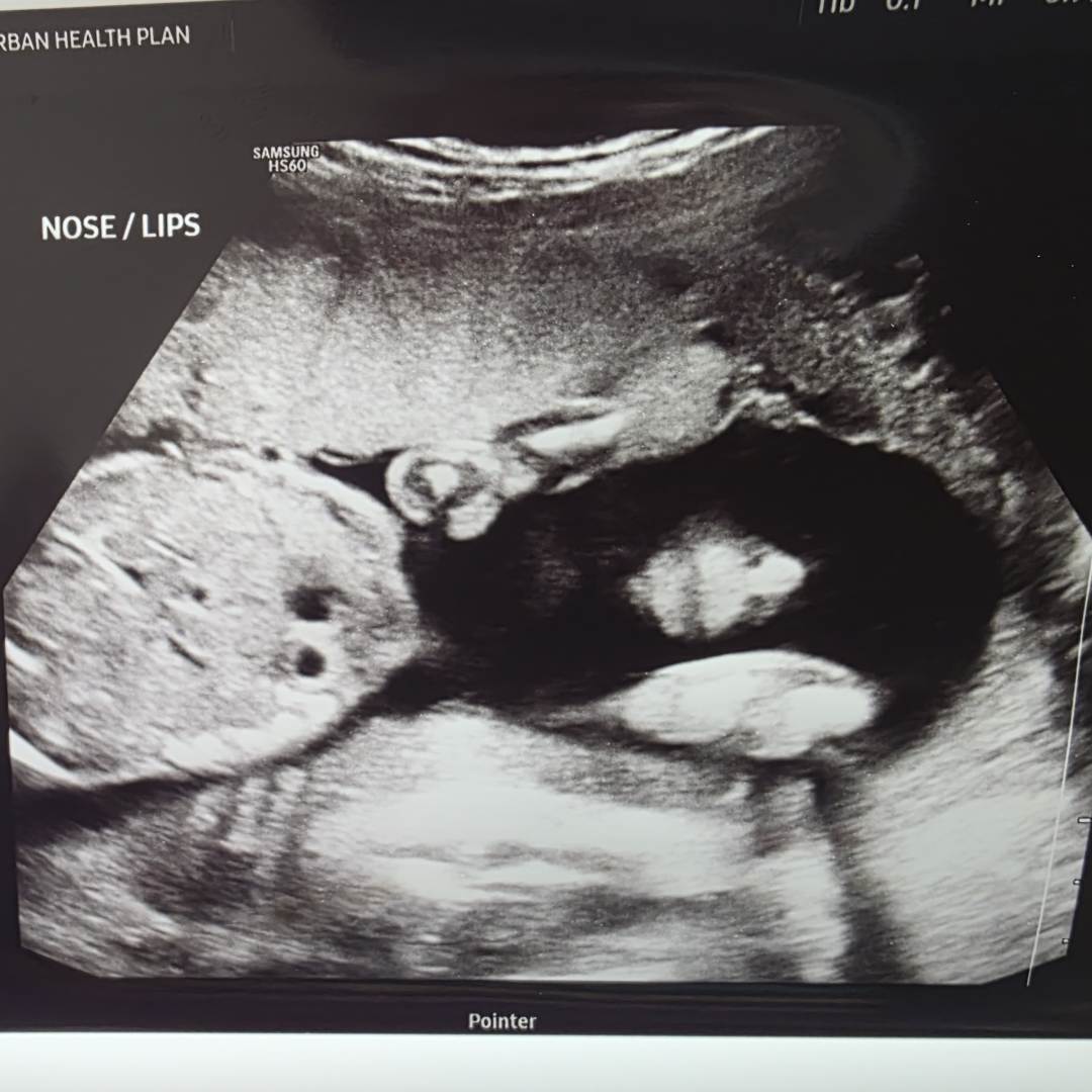 Photo shared by Jasmin for their Babylist baby registry.