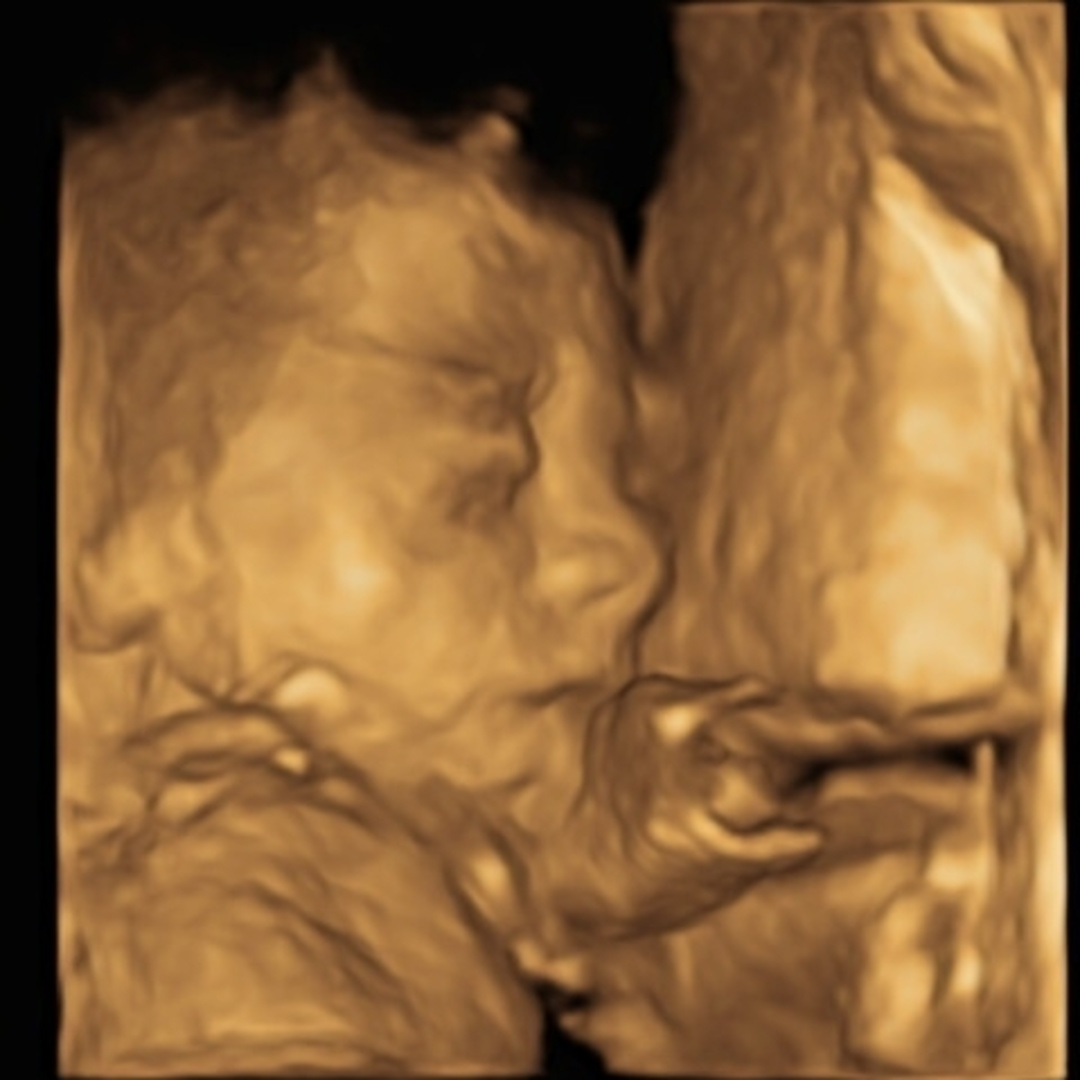 Photo shared by Destiny for their Babylist baby registry.