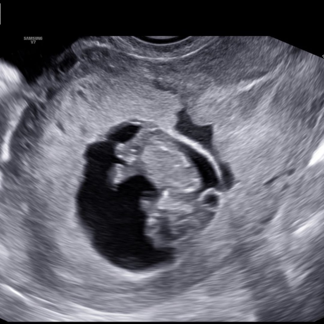 Photo shared by Samantha for their Babylist baby registry.