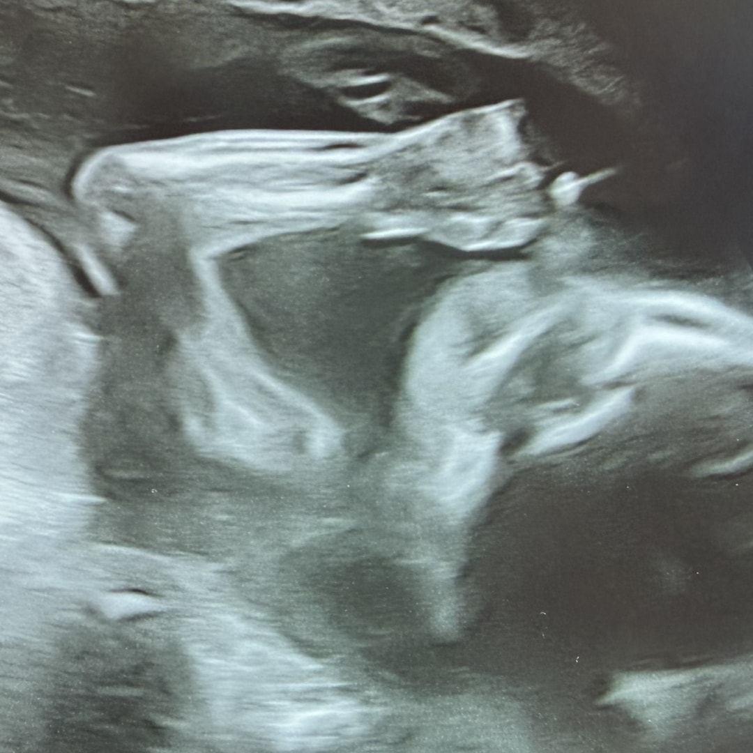 Photo shared by Catherine for their Babylist baby registry.