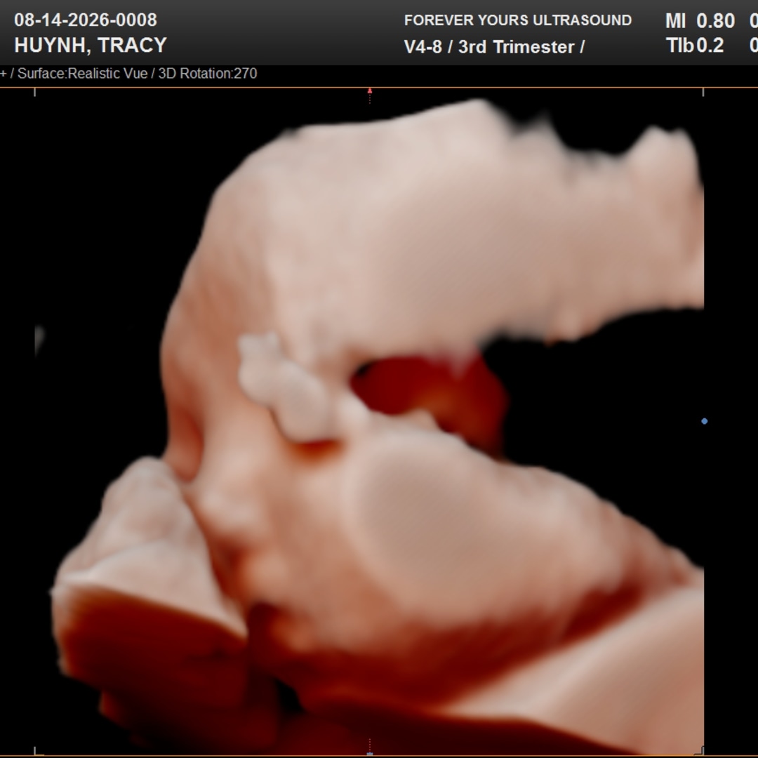 Photo shared by Tracy for their Babylist baby registry.