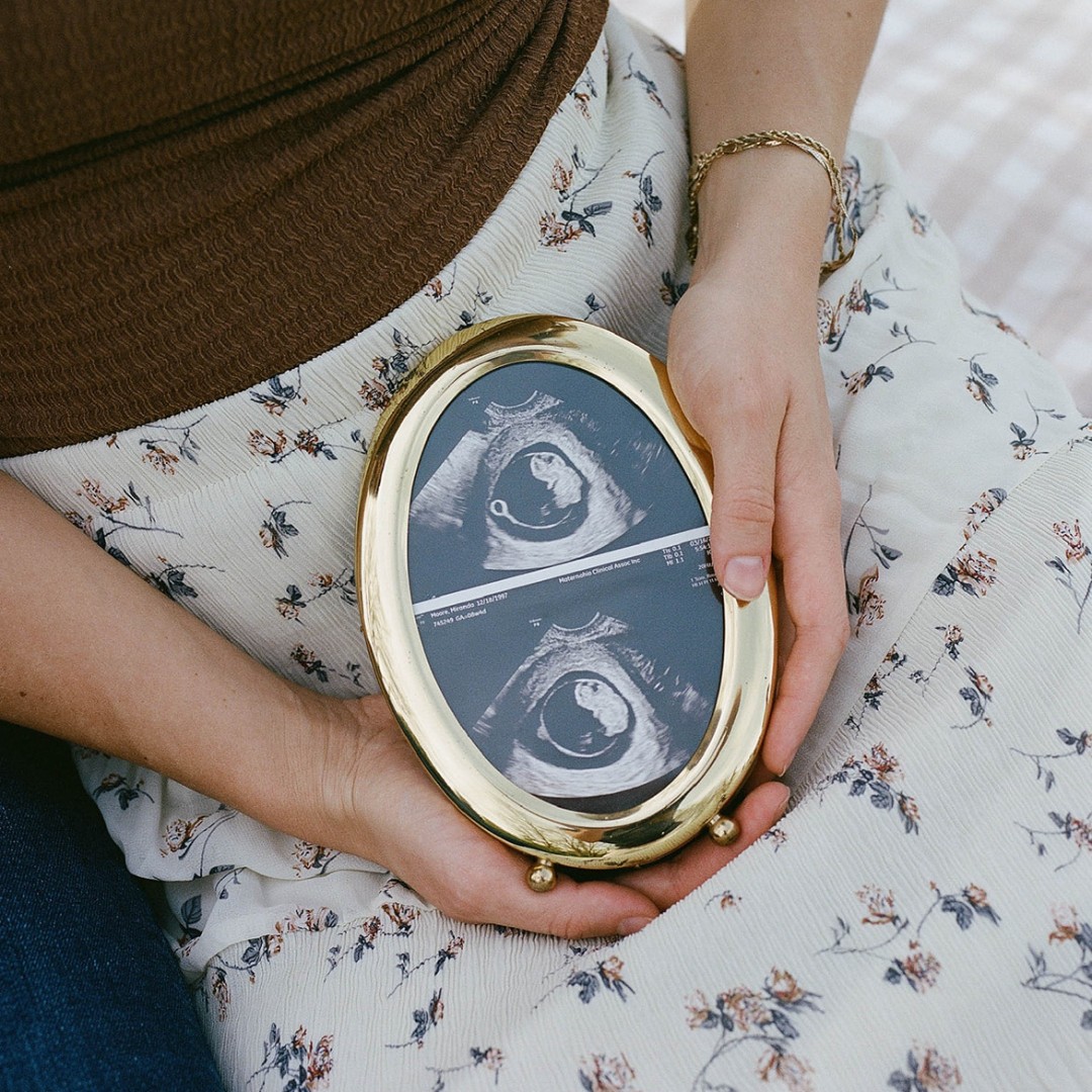 Photo shared by Miranda for their Babylist baby registry.