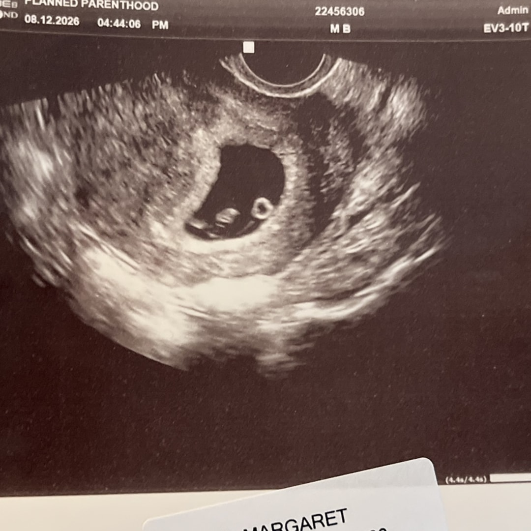 Photo shared by Maggie for their Babylist baby registry.