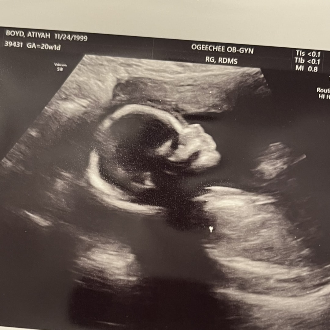Photo shared by Atiyah for their Babylist baby registry.