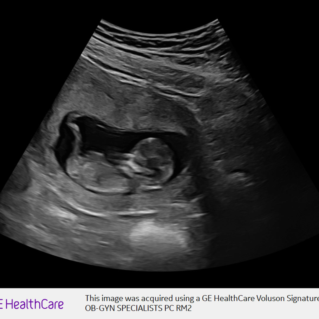 Photo shared by Madason for their Babylist baby registry.