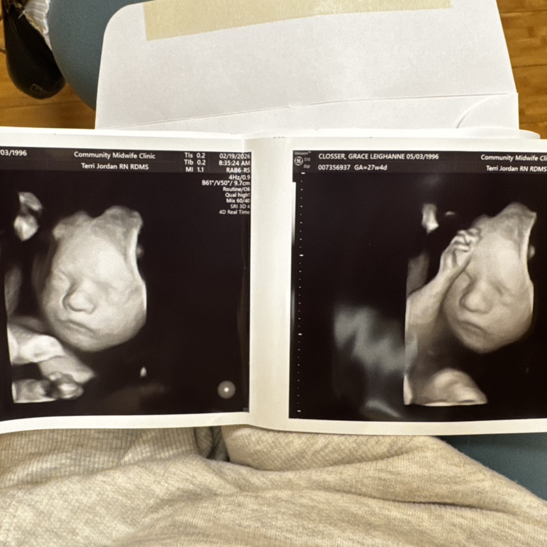 Photo shared by Grace for their Babylist baby registry.