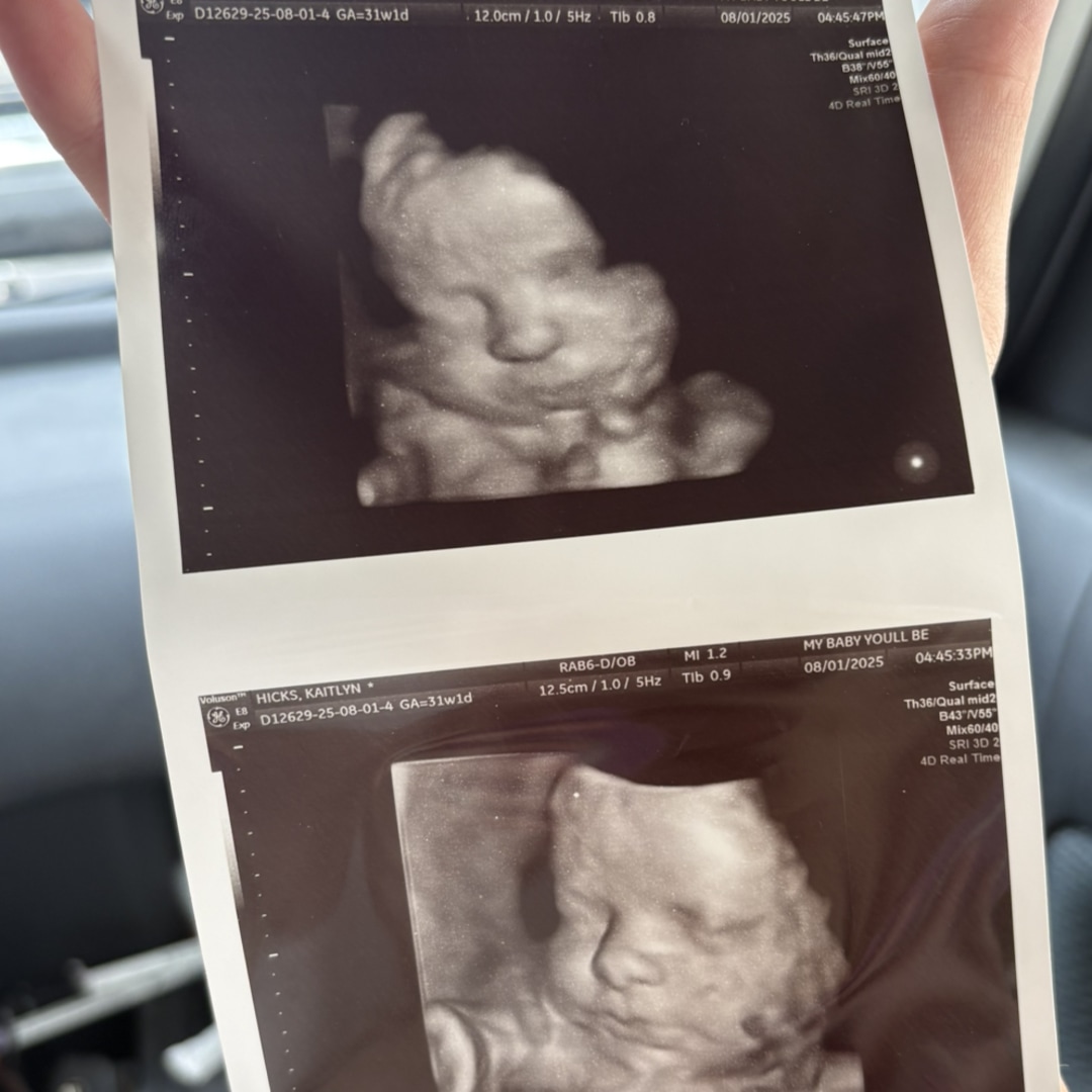 Photo shared by Kat for their Babylist baby registry.
