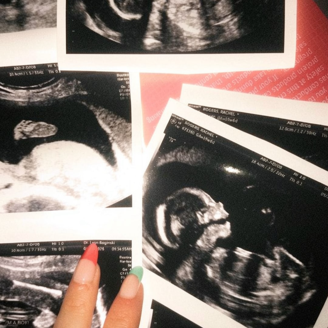 Photo shared by Rachel for their Babylist baby registry.