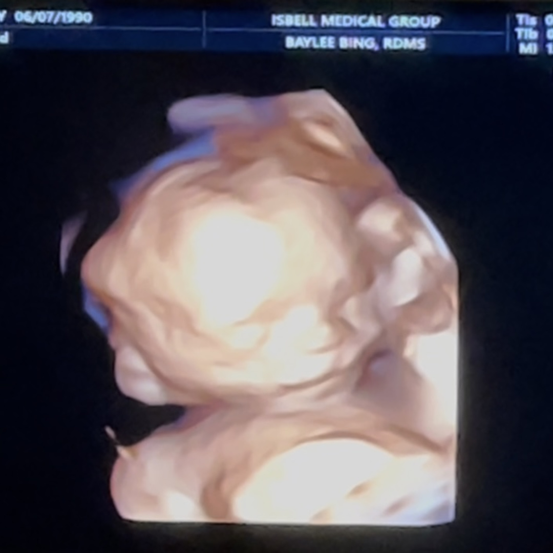 Photo shared by Casey for their Babylist baby registry.