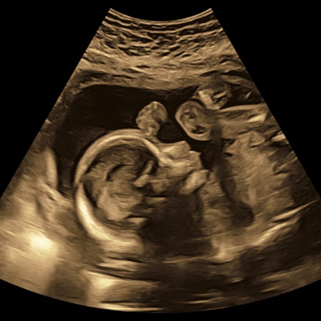 Photo shared by Shalyce for their Babylist baby registry.