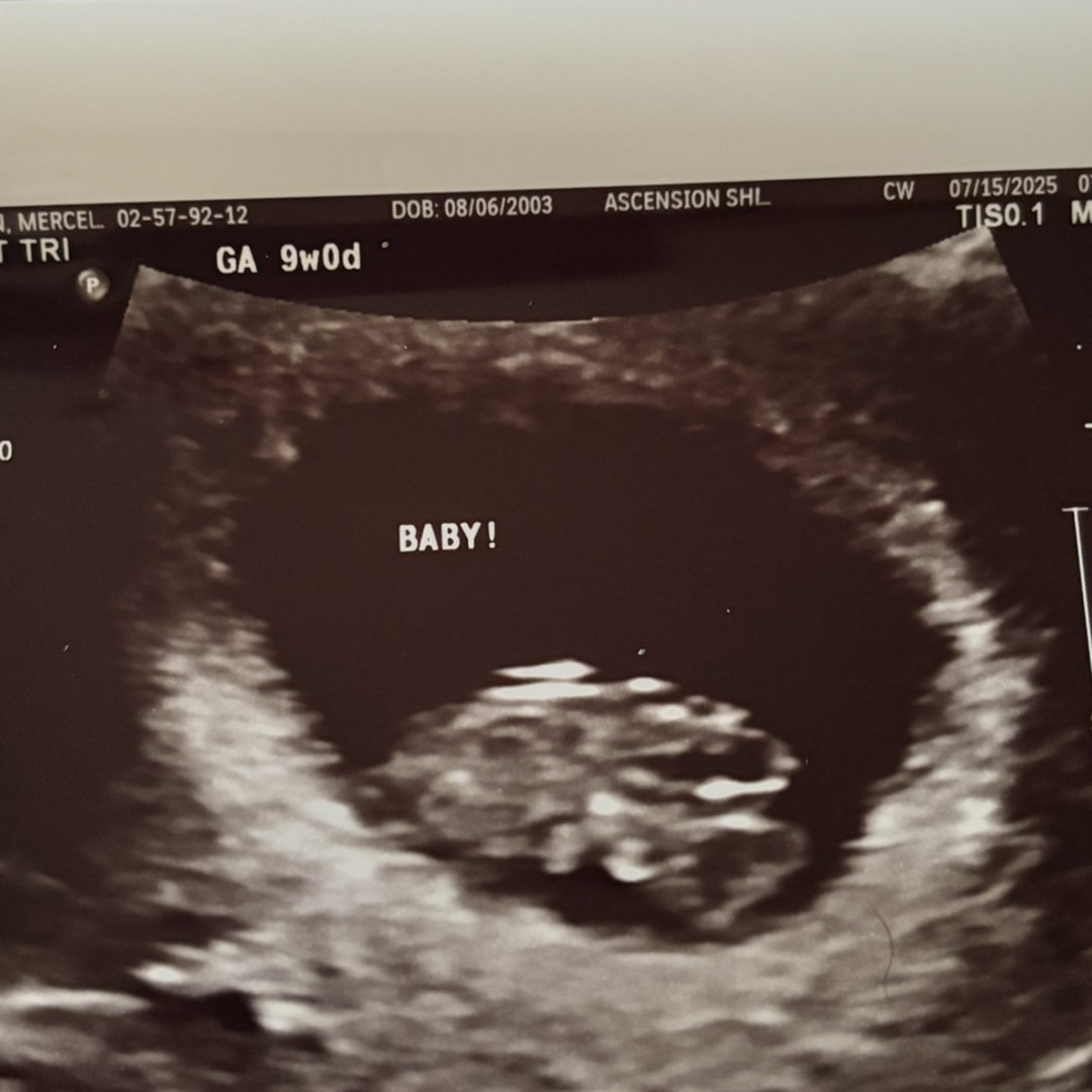 Photo shared by Mercedes for their Babylist baby registry.