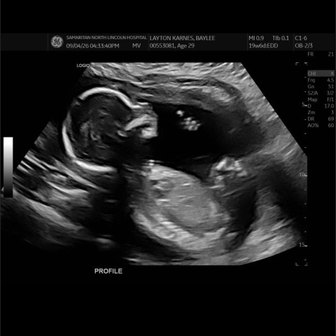Photo shared by BayLee for their Babylist baby registry.