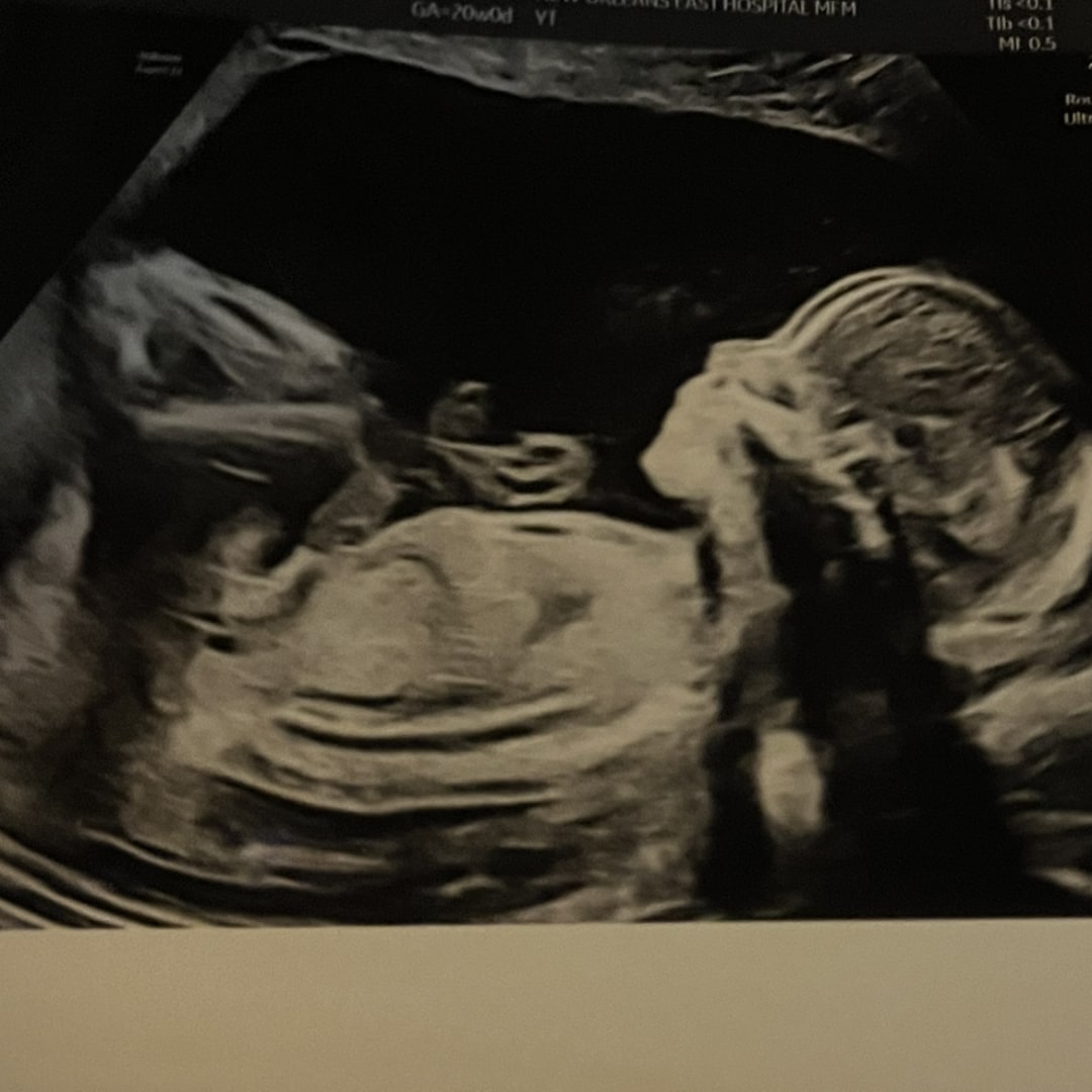 Photo shared by Winter for their Babylist baby registry.