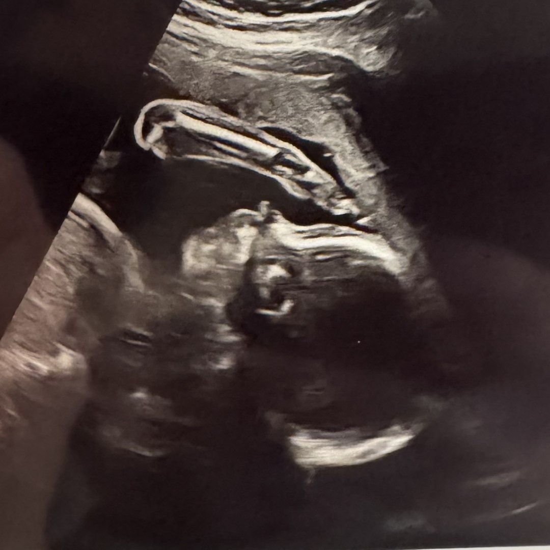 Photo shared by Erin for their Babylist baby registry.