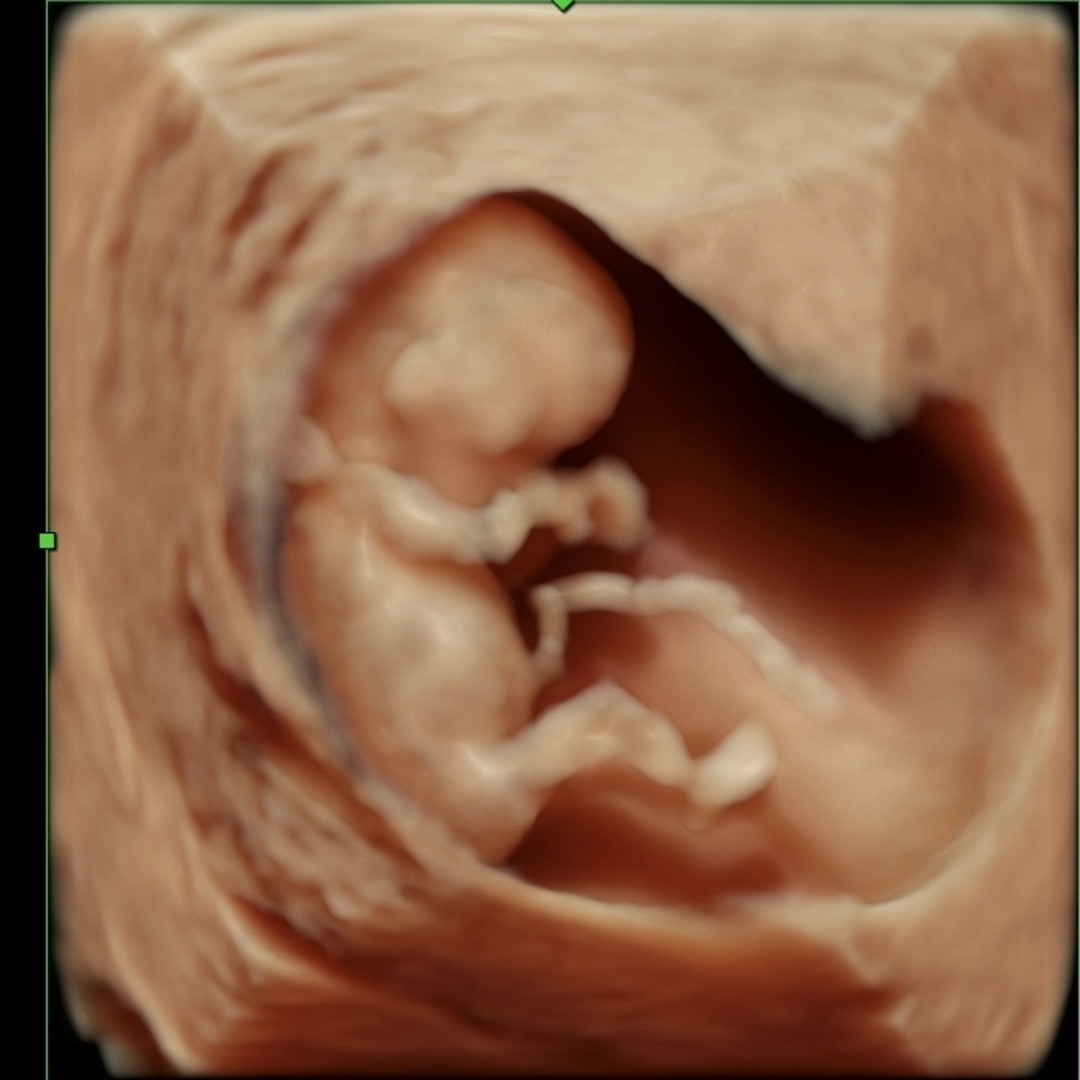 Photo shared by Josie for their Babylist baby registry.