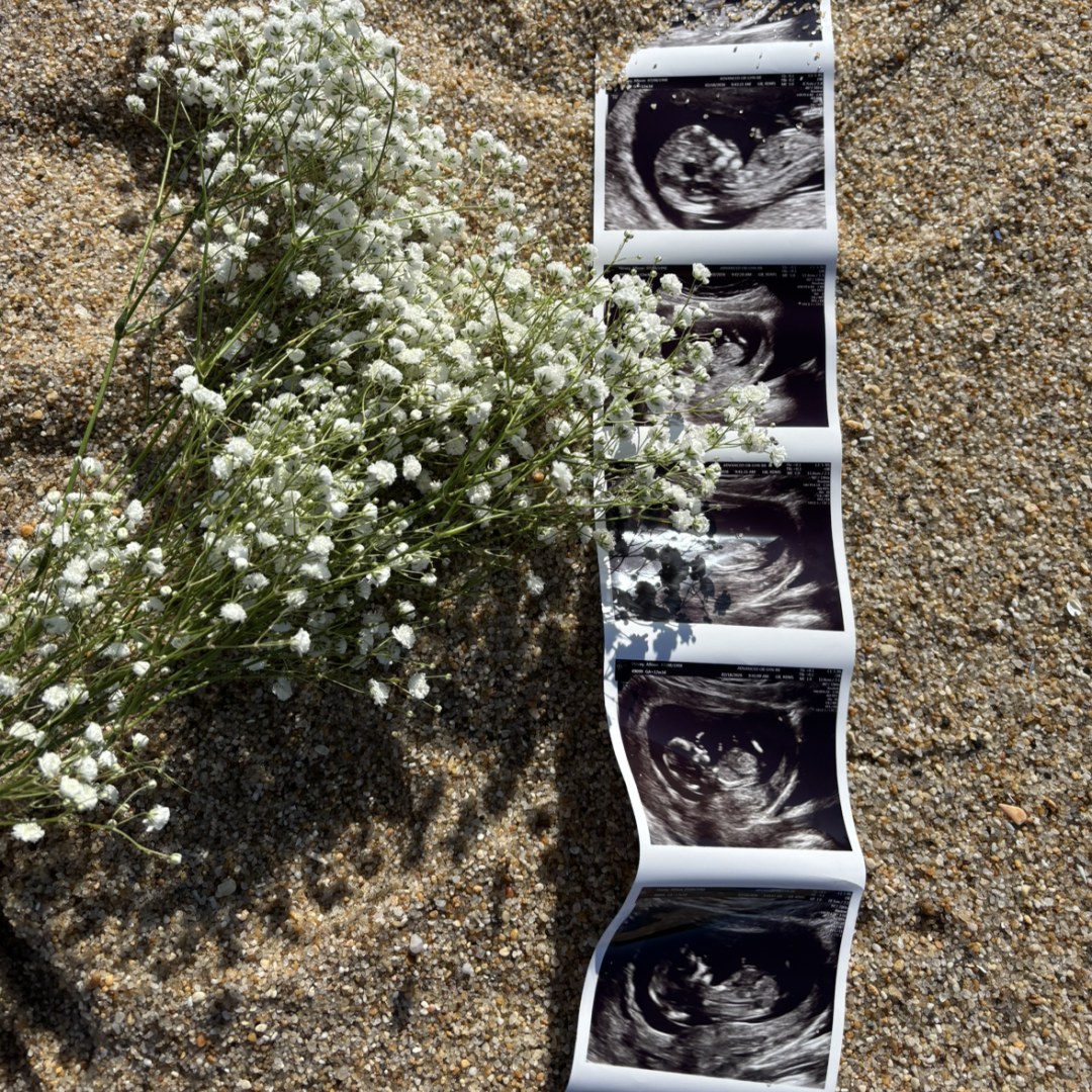 Photo shared by Allison for their Babylist baby registry.