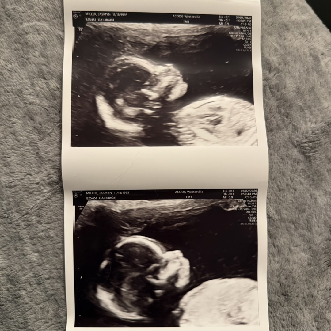 Photo shared by Jasmyn for their Babylist baby registry.