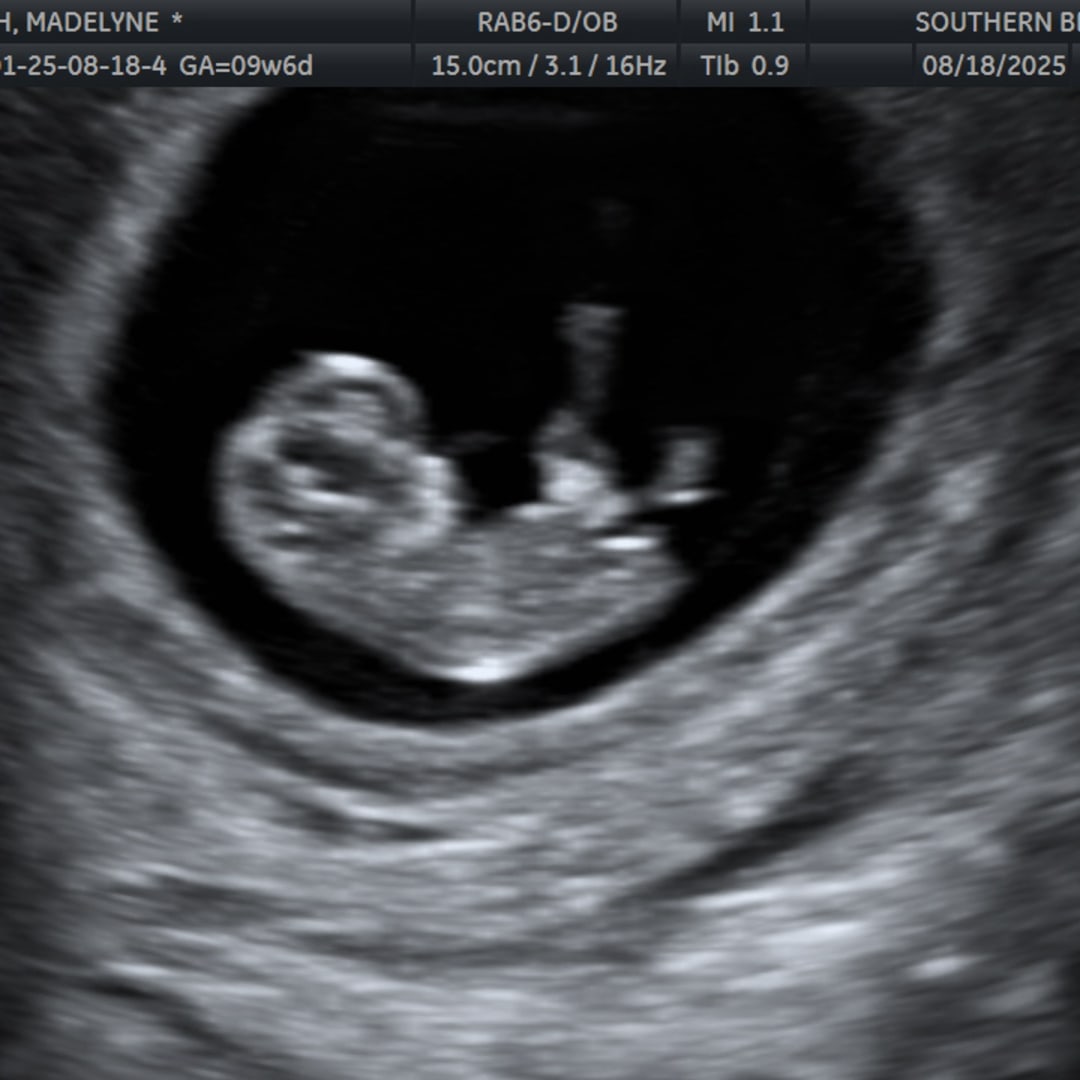 Photo shared by Madelyne for their Babylist baby registry.