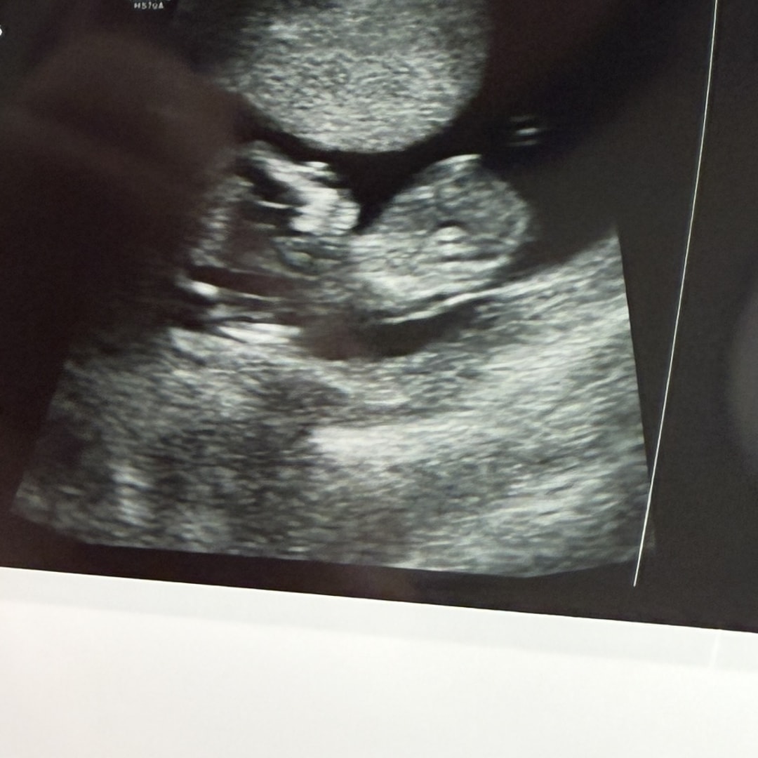 Photo shared by Thary for their Babylist baby registry.