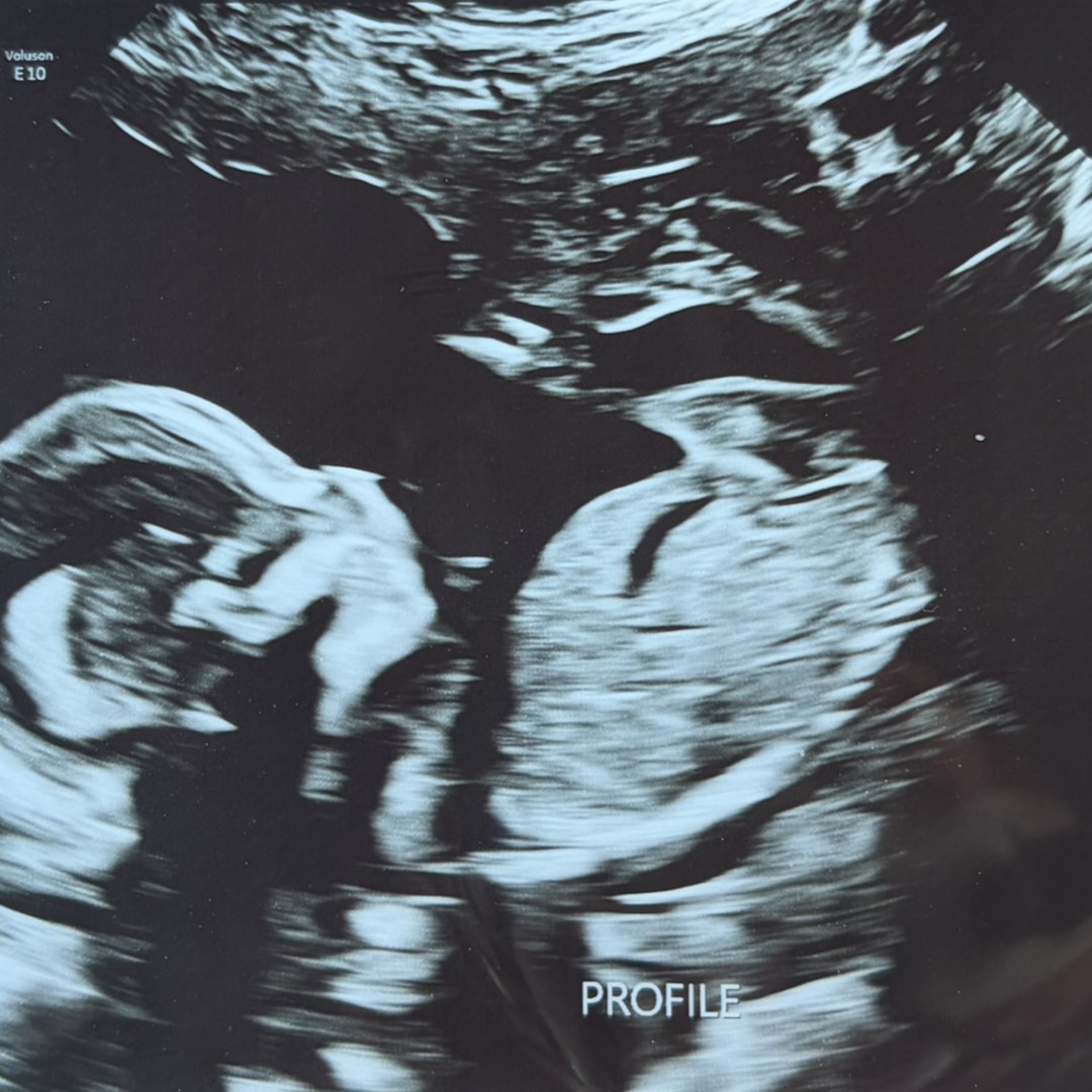 Photo shared by Aubrey for their Babylist baby registry.