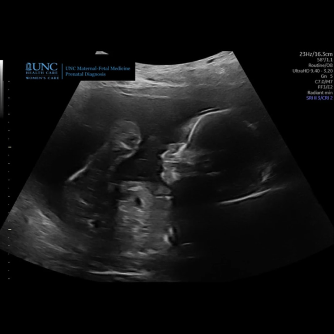 Photo shared by Daniela for their Babylist baby registry.