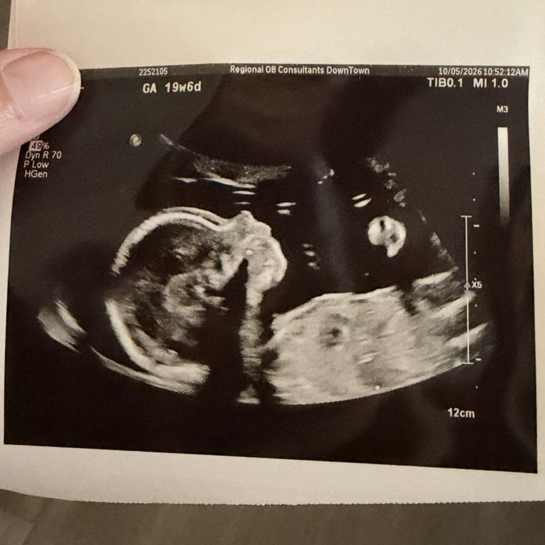 Photo shared by Kelley for their Babylist baby registry.