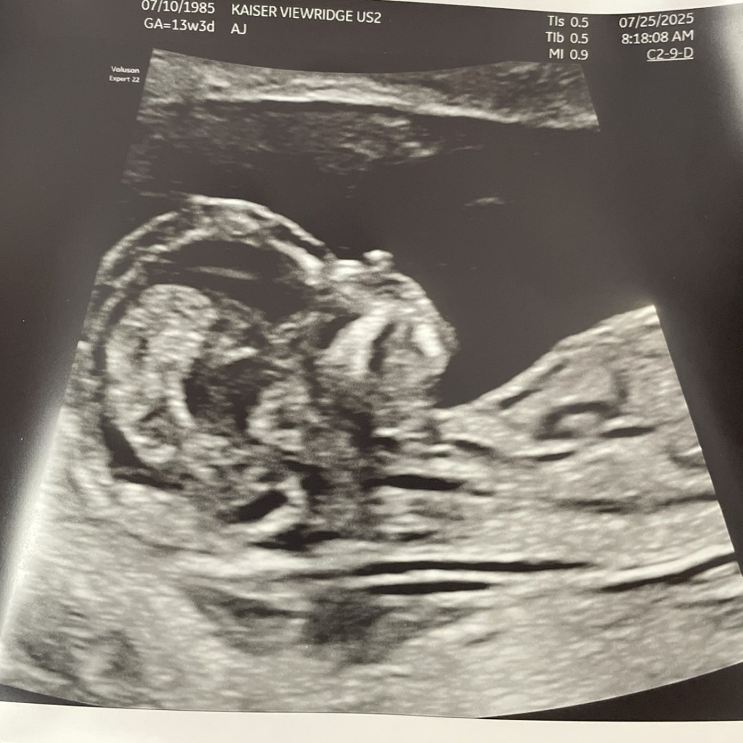 Photo shared by Calli for their Babylist baby registry.