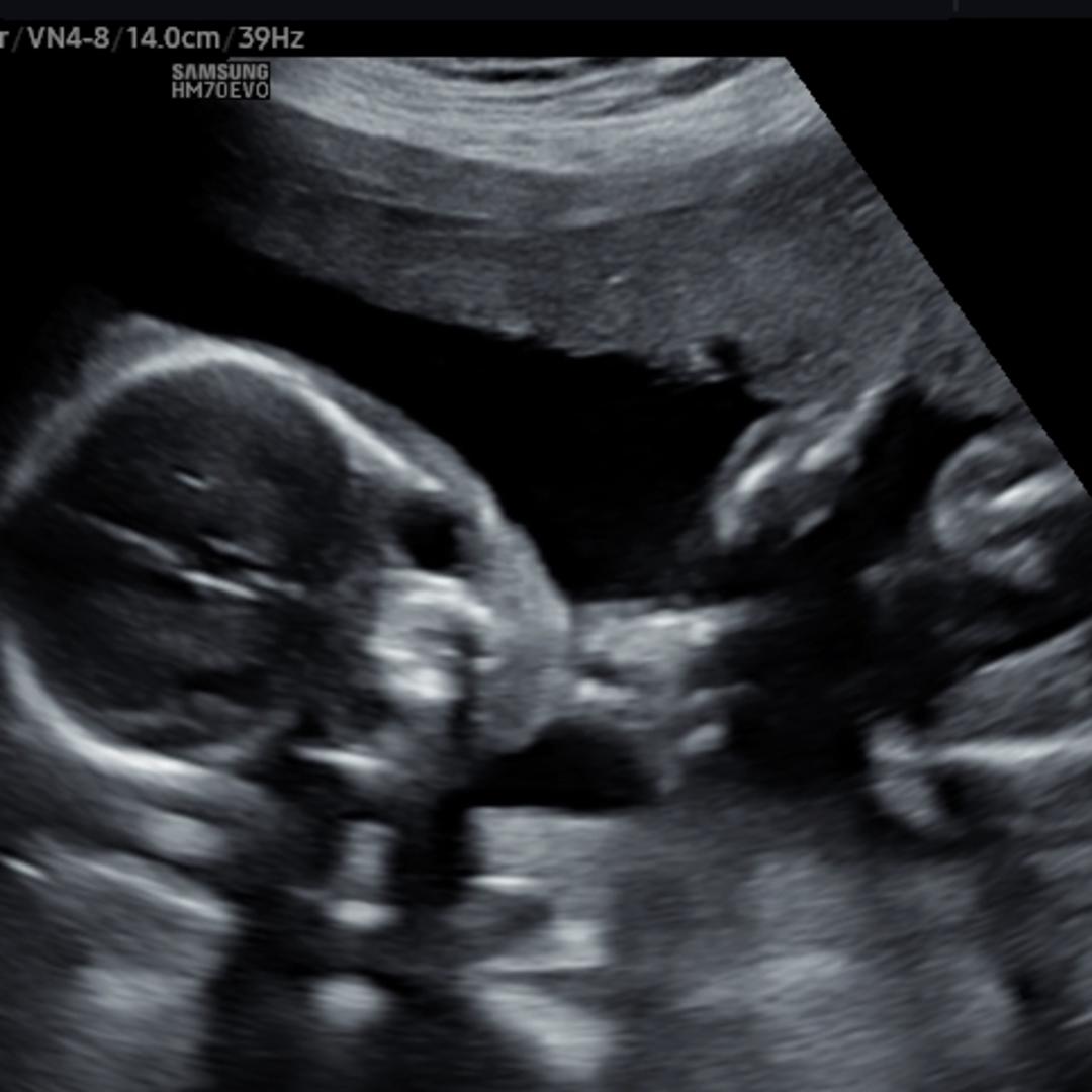 Photo shared by Merrie for their Babylist baby registry.