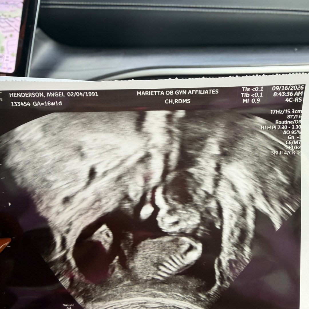 Photo shared by Angel for their Babylist baby registry.
