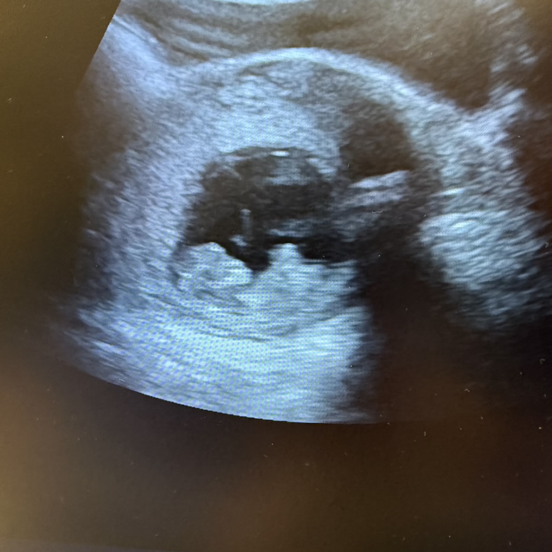 Photo shared by Jordan for their Babylist baby registry.