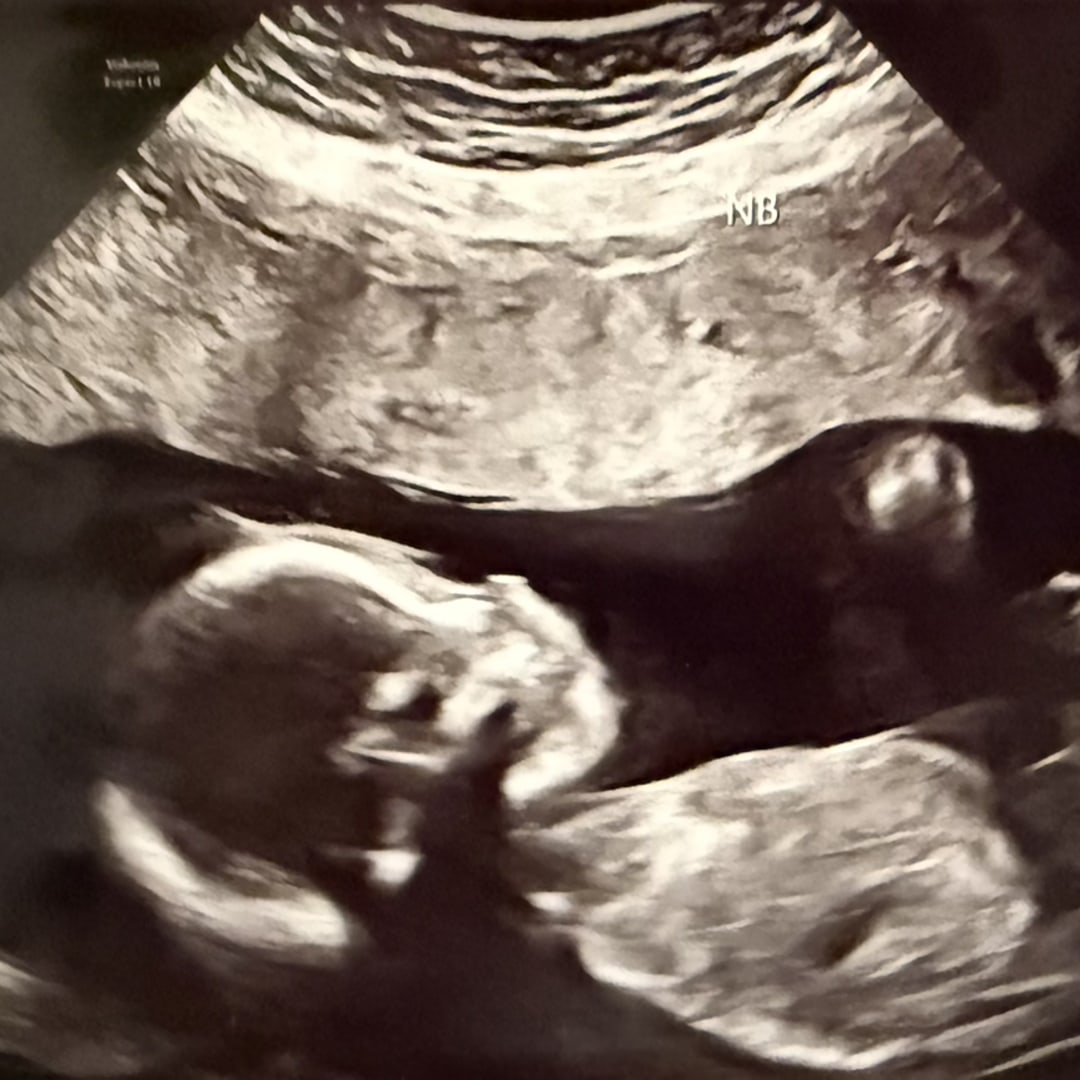 Photo shared by Andrew Freeman for their Babylist baby registry.