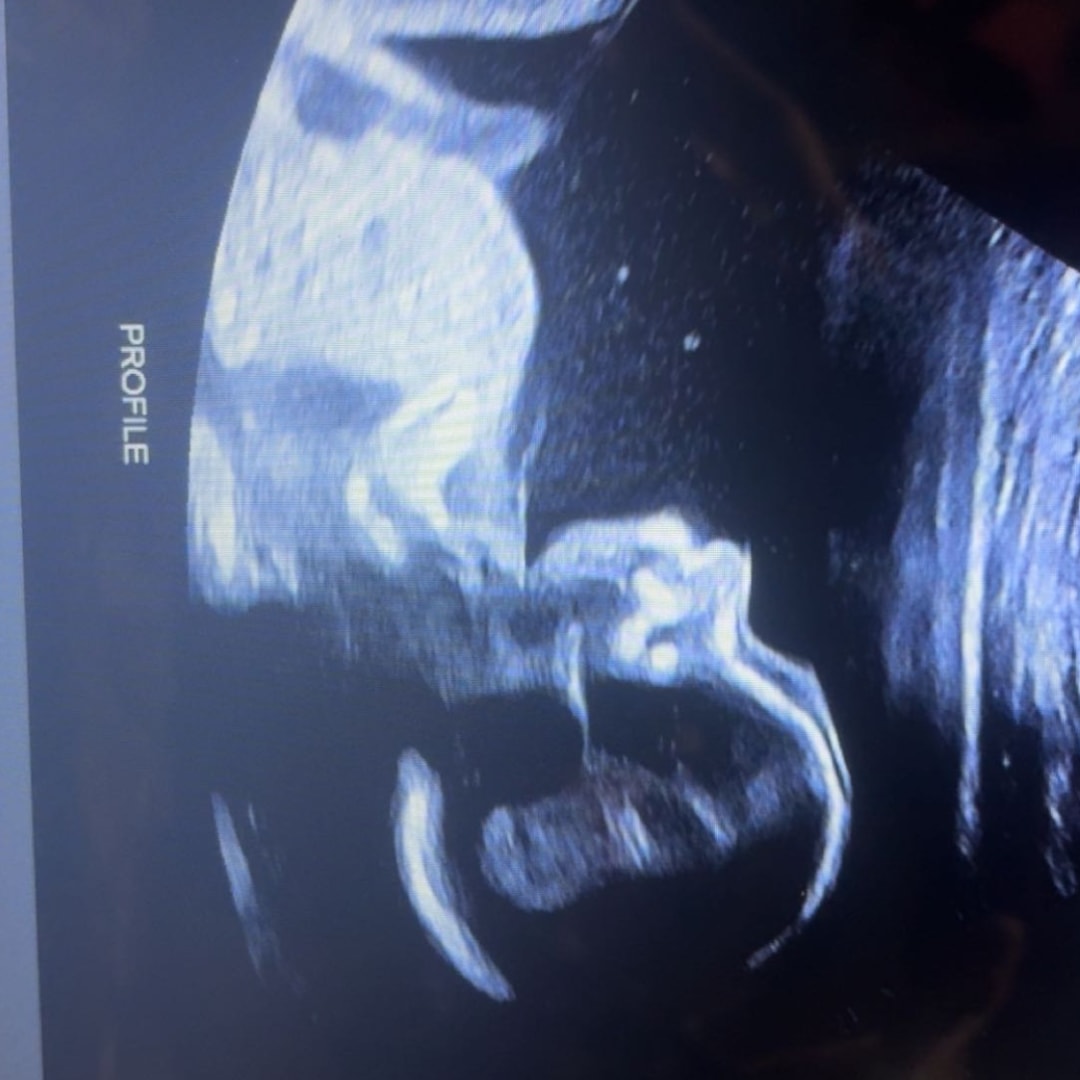 Photo shared by Clara for their Babylist baby registry.