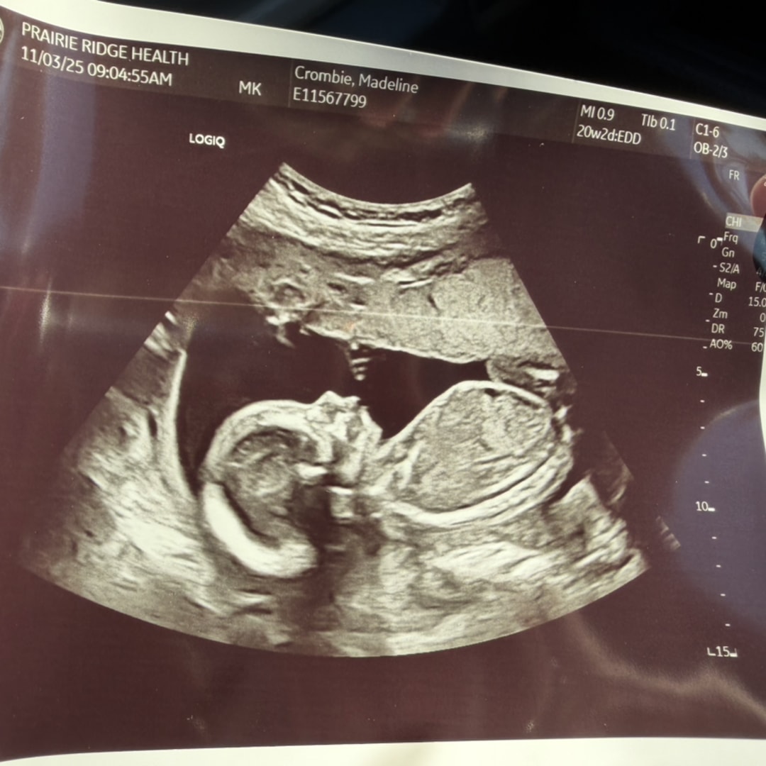 Photo shared by Madeline for their Babylist baby registry.