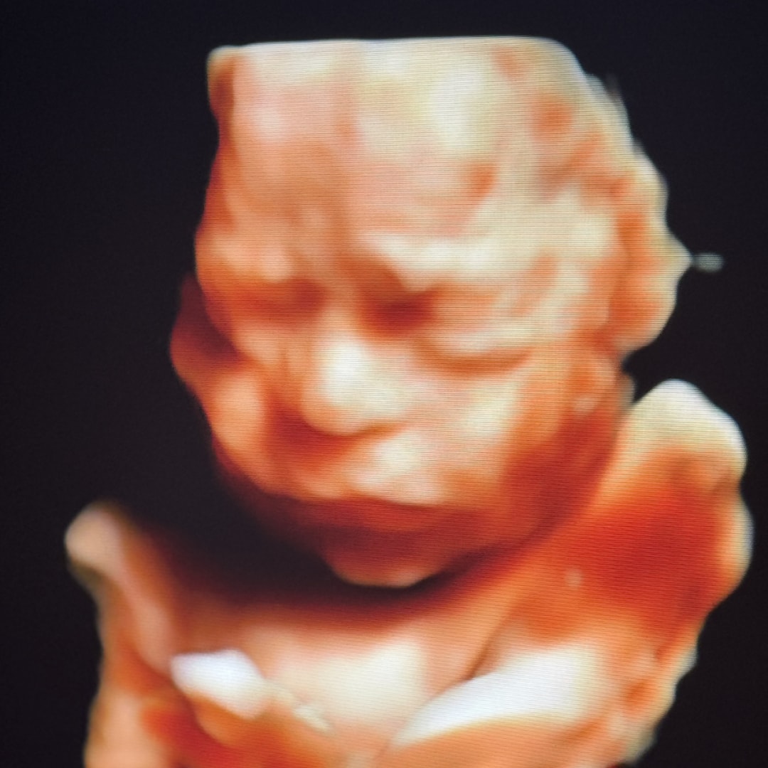 Photo shared by Janibel for their Babylist baby registry.