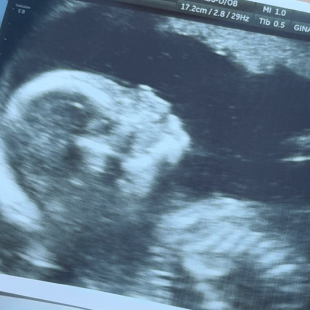 Photo shared by Ally for their Babylist baby registry.