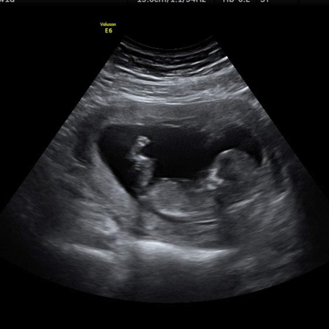 Photo shared by Kelsey for their Babylist baby registry.