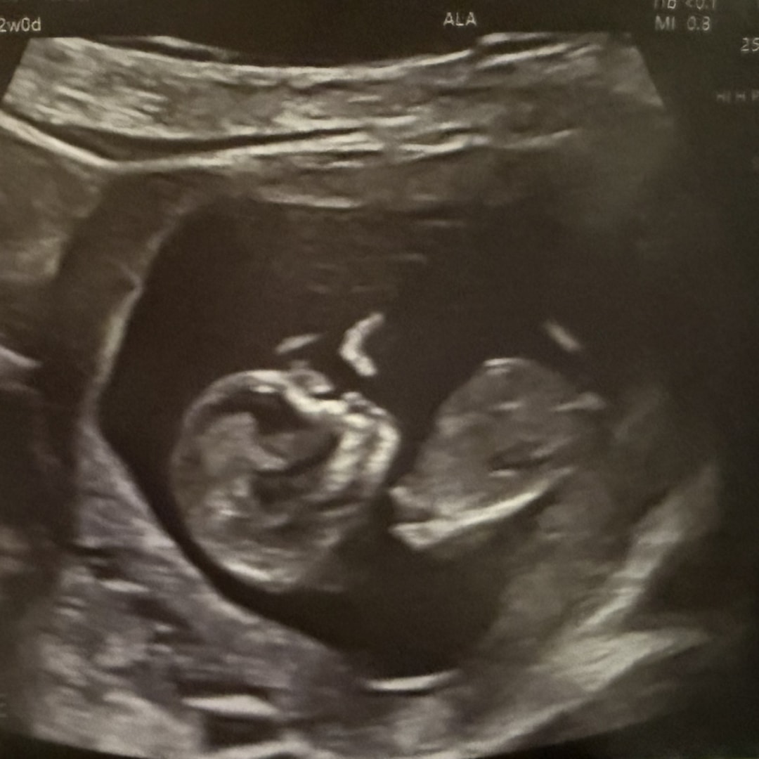 Photo shared by Ashley for their Babylist baby registry.