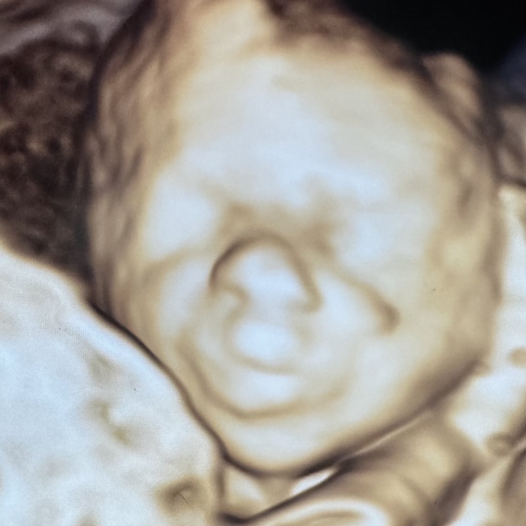 Photo shared by Alyssa for their Babylist baby registry.