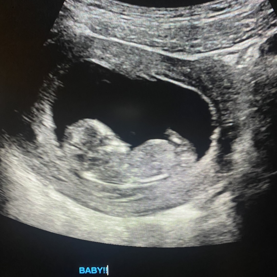 Photo shared by Amiyah for their Babylist baby registry.