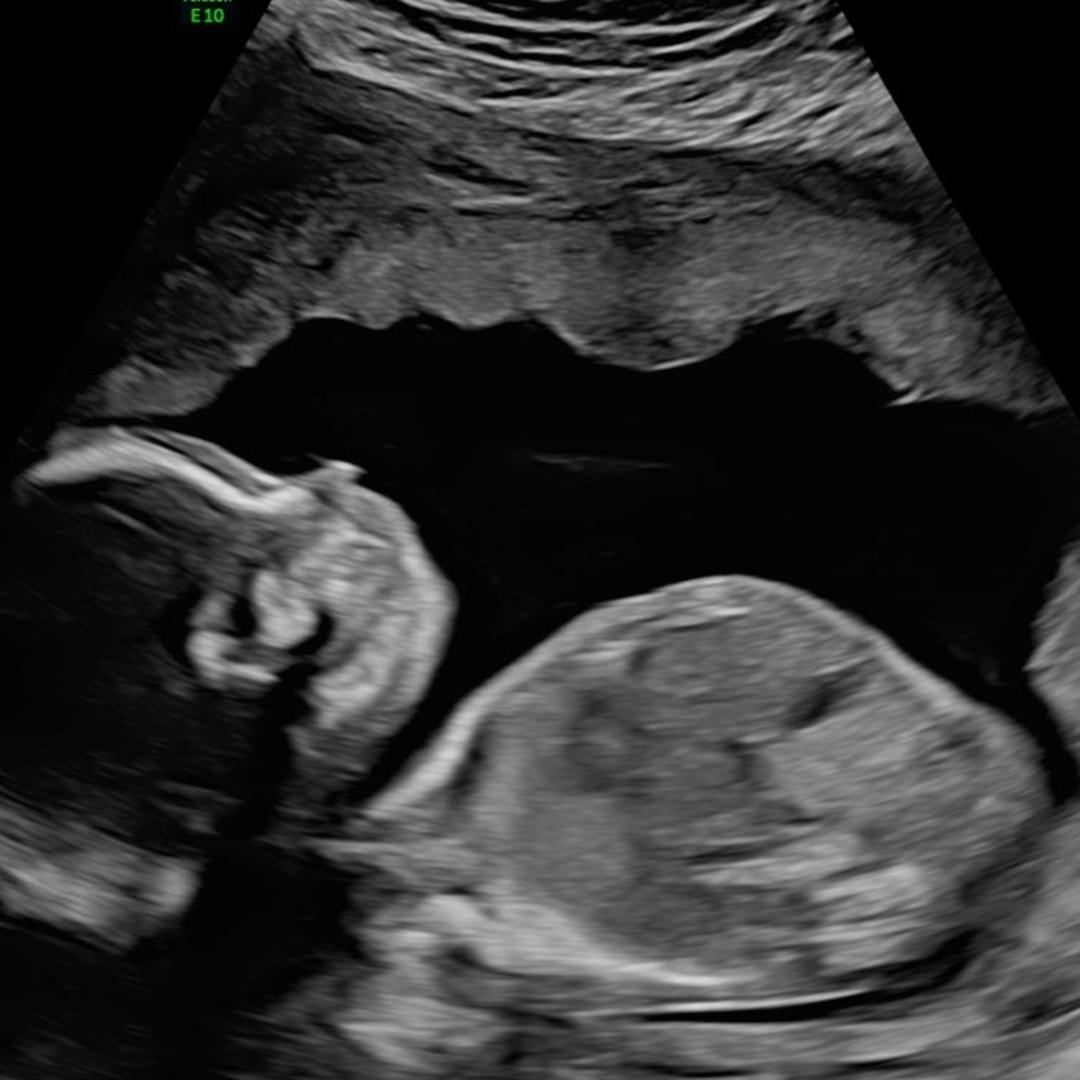 Photo shared by Alisha for their Babylist baby registry.
