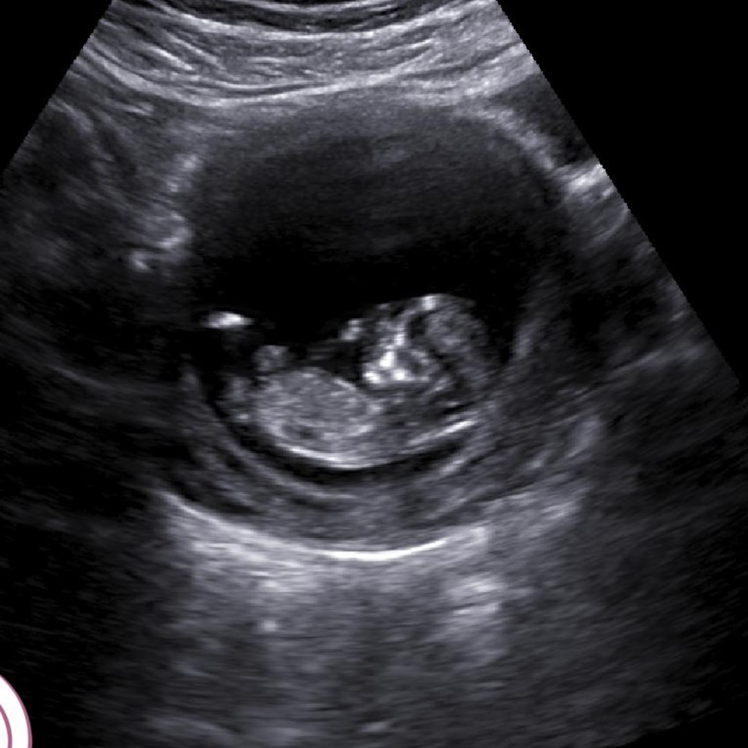 Photo shared by Lisset for their Babylist baby registry.