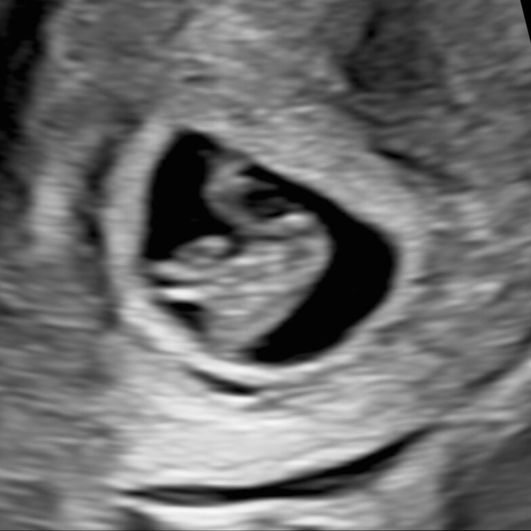 Photo shared by Grace for their Babylist baby registry.