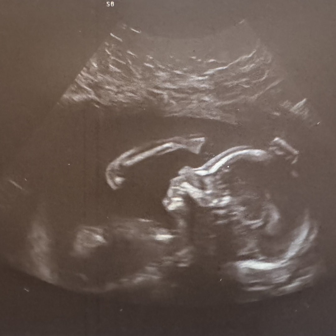 Photo shared by Amber for their Babylist baby registry.