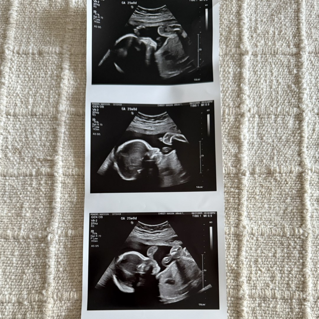 Photo shared by Madison for their Babylist baby registry.