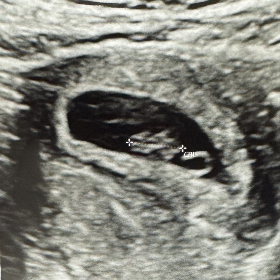 Photo shared by Emily for their Babylist baby registry.