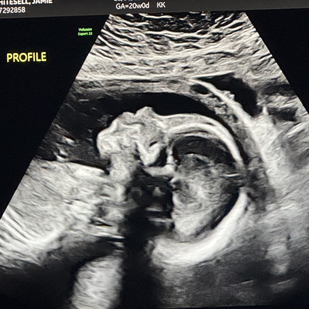 Photo shared by Jamie for their Babylist baby registry.