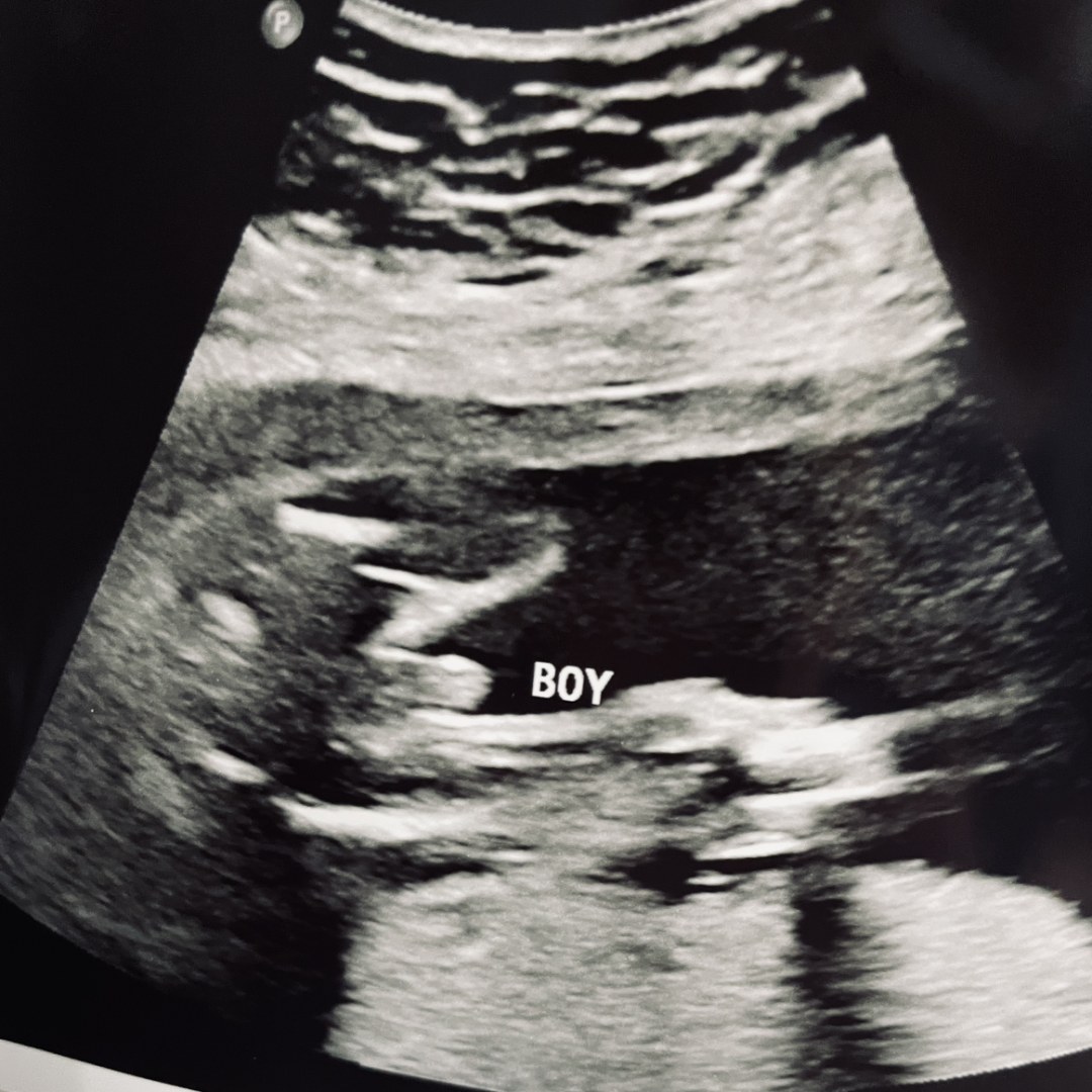 Photo shared by Dessiree for their Babylist baby registry.