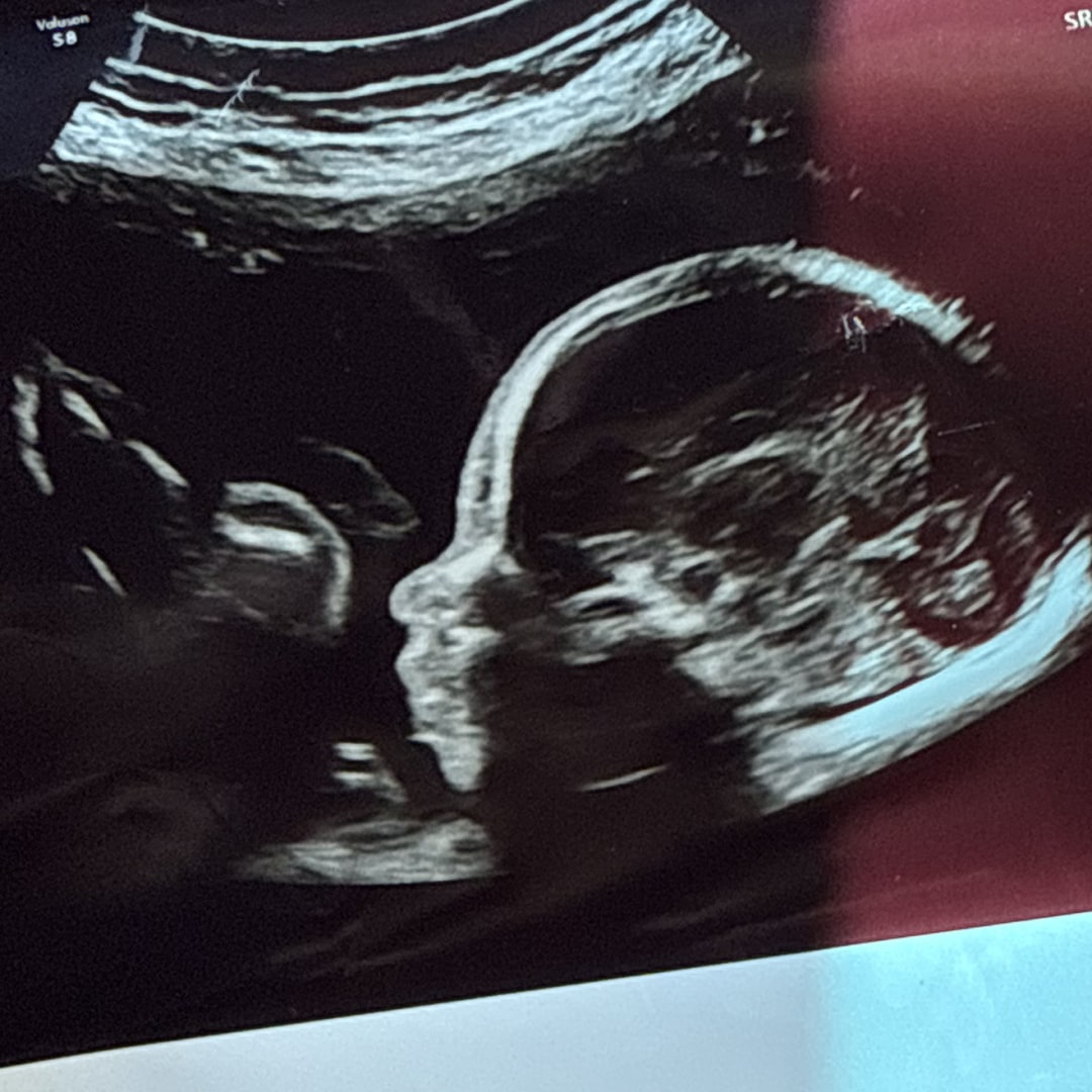 Photo shared by Deziree for their Babylist baby registry.