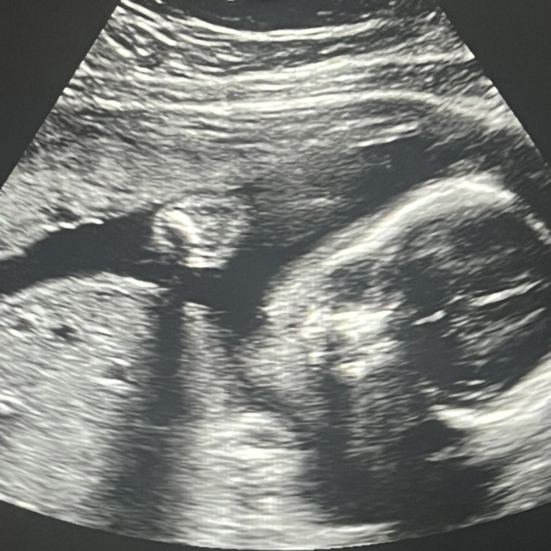Photo shared by Tiffany for their Babylist baby registry.